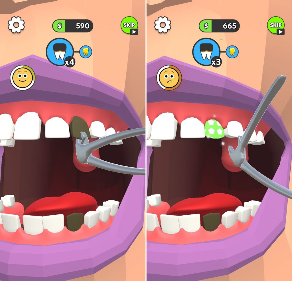 Dentist Bling レビュー 歯医者となって患者の輝く歯を取り戻すゲーム Gamefoliage